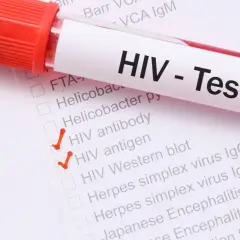 Test HIV - objawy u mężczyzn. Zaznaczone pozycje: przeciwciała HIV, antygen HIV.