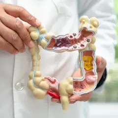 Model jelit w rękach lekarza, ilustrujący, jak oczyścić jelita. Widać fragmenty zanieczyszczeń.