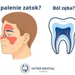 Zapalenie zatok czy ból zęba? Ilustracja przedstawia profil twarzy z zaznaczonymi zatokami oraz przekrój zęba.