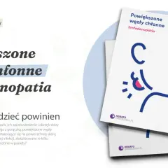 Broszura dla pacjentów o powiększonych węzłach chłonnych (limfadenopatii). Opisuje objawy i kiedy należy się martwić.