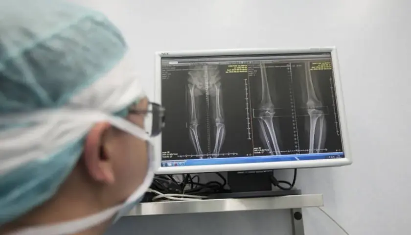 Chirurg w masce i czepku analizuje na monitorze zdjęcia RTG kończyn dolnych.
