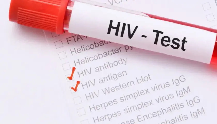 Test HIV - objawy u mężczyzn. Zaznaczone pozycje: przeciwciała HIV, antygen HIV.