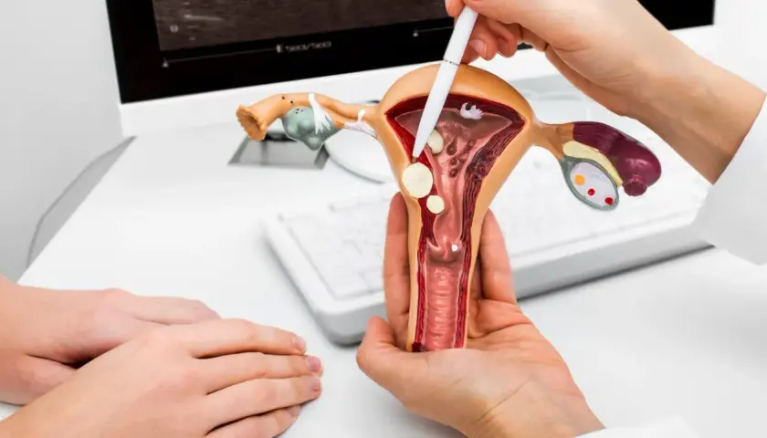 Model narządu rodnego kobiety z zaznaczonymi zmianami, które mogą wskazywać na raka endometrium. Lekarz wyjaśnia pacjentce.