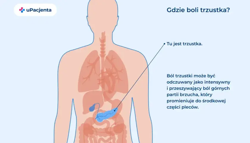 Ilustracja pokazuje ludzkie ciało z zaznaczoną trzustką. Ból trzustki odczuwany jest w górnej części brzucha i promieniuje do pleców.