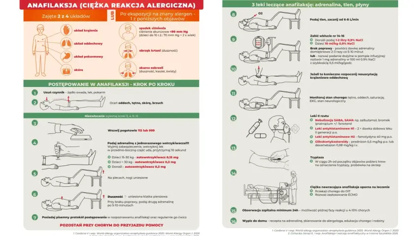 Ilustracja przedstawia schemat postępowania w anafilaksji, ciężkiej reakcji alergicznej, która może być wywołana przez pokarm.