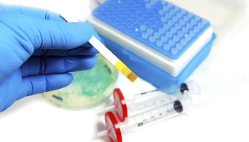 Rękawiczka w niebieskiej rękawiczce trzyma pasek testowy, który może pomóc w diagnozowaniu kwasicy mleczanowej. W tle widać sprzęt laboratoryjny.