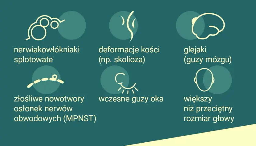 Objawy neurofibromatozy: nerwiakowłókniaki, deformacje kości, glejaki, guzy oka, MPNST, większa głowa.