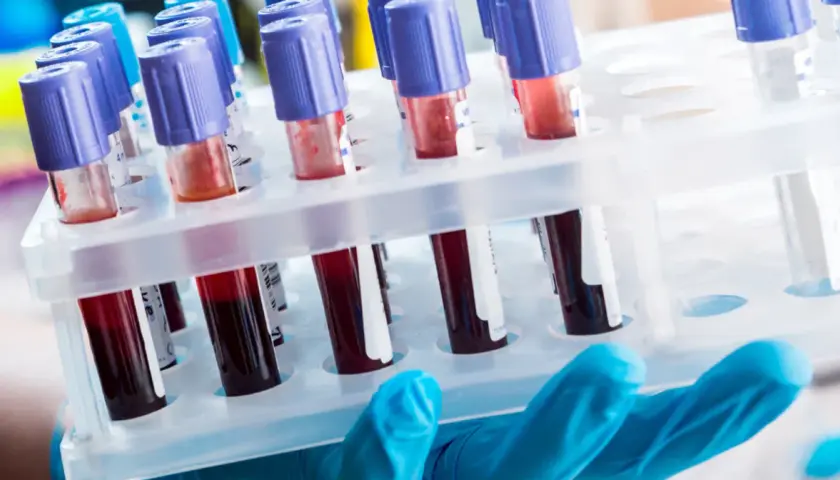 Diagnosta laboratoryjny i inni: Kto odpowiada za Twoje wyniki?