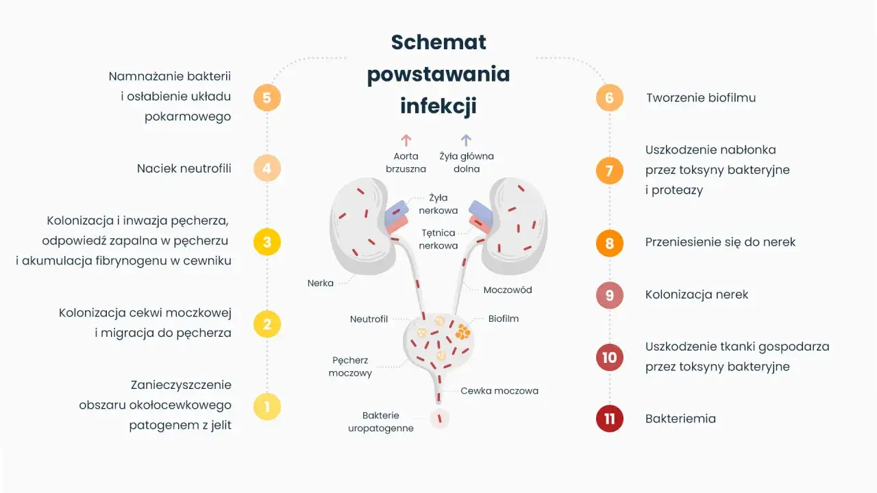 Schemat powstawania infekcji dróg moczowych: od namnażania bakterii, przez kolonizację pęcherza, po uszkodzenie nerek i bakteriemię.