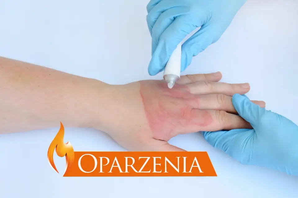 Rana - jak opatrzyć uraz i kiedy potrzebny jest lekarz